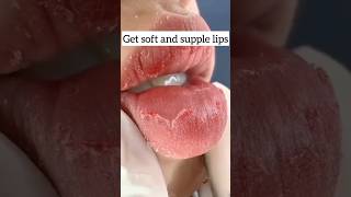 Chapped lips treatment get soft and supple lips short video 😱🔥👍 [upl. by Ade590]