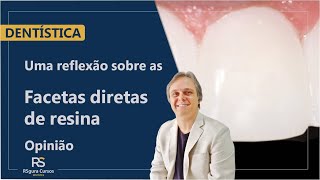 Uma reflexão sobre as Facetas de Resina Composta Opinião [upl. by Hcone408]