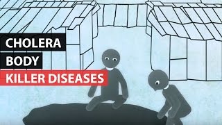 KILLER DISEASES  How the Body Reacts to Cholera [upl. by Aennaej]