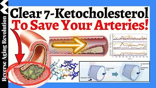 Clear 7Ketocholesterol To SAVE Your Arteries A NOVEL Approach To Heart Health [upl. by Hannavahs]