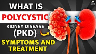 Polycystic Kidney Disease PKD ADPKD ARPKD Treatment Symptoms Causes [upl. by Schou]