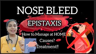 EPISTAXIS🩸 NOSE BLEED नकसीर How to Manage at HOME 🏠 Causes Treatment In details epistaxis [upl. by Pebrook]