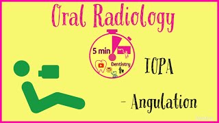 IOPA ANGULATION  BISECTING ANGLE TECHNIQUE  ORAL RADIOLOGY  5 min DENTISTRY  MNEMONICS [upl. by Anastatius]