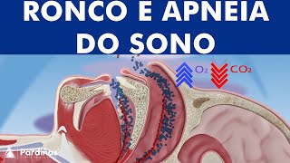 Ronco apneia do sono © [upl. by Gustave]