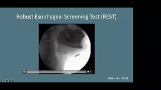 The ‘Anatomy’ of Esophageal Dysphagia Current State and Future Direction [upl. by Agosto]