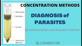 SEDIMENTATION amp FLOATATION \\CONCENTRATION METHODS FOR PARASITIC DIAGNOSIS pathology microbio [upl. by Larok545]