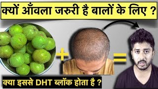 Amla for Hair Growth  Skin and Health  क्या आँवला से बाल झड़ना बंद होता है Genuine Tips [upl. by Esirehs376]