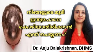 Alopecia areata in malayalam  Hair loss treatment in malayalam  Home remedies for alopecia areata [upl. by Aneerol]