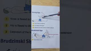 Kernig sign And Brudzenski sign  Acute Meningitis [upl. by Gustav757]