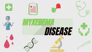 Myxedema Definition Symptoms Diagnosis Treatment [upl. by Akcinahs]