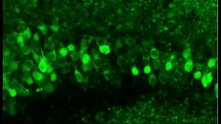 Monitoring neuronal activity in brain slices from a 2 year old Thy1GCaMP3 transgenic mouse [upl. by Cordey]