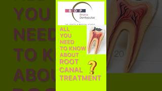 Need a Root Canal Treatment Watch this first rct smile teeth [upl. by Akceber]