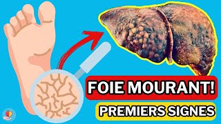 LE FOIE est en train de MOURIR 15 Signes étranges de DOMMAGES AU FOIE [upl. by Mairhpe]