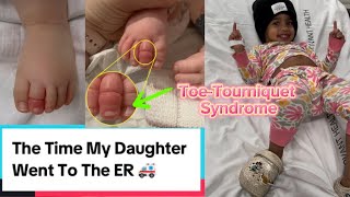 The Time My Daughter Went To The ER Toe Tourniquet Syndrome parent toddlers funny goodjobdad [upl. by Nayab]