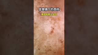 荔枝放大2000倍，看完你还敢吃吗 显微镜下的世界 microscope science 科普shorts [upl. by Bowen]