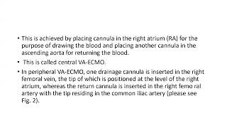 Basics of ECMO [upl. by Smail]