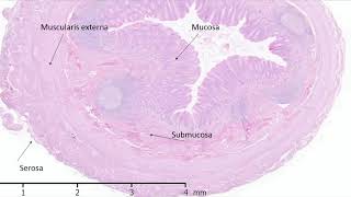 Histology of the Appendix [upl. by Brand]