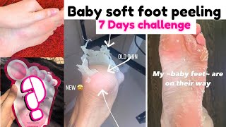 Crazy Foot Peel Mask 7 Days Challenge  Baby soft Foot Mask  Foot Peeling and Whitening Mask [upl. by Fredra]