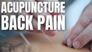 Acupuncture For Back Pain [upl. by Htepsle522]