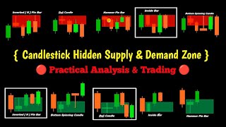 How To Predict Candle Under Supply amp Demand Zones  Simple To Analysis amp The With Trading  binary [upl. by Myrah]