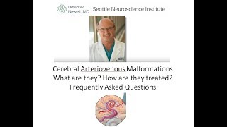 Cerebral Arteriovenous Malformations Frequently asked questions [upl. by Dorcus]