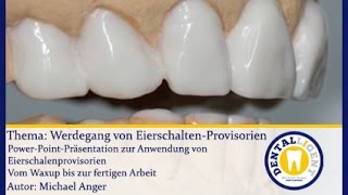 ZahntechnikGRATISWerdegang von EierschalenProvisorien [upl. by Anilas]