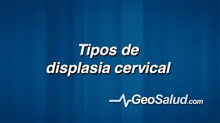 Cuáles son los tipos de la displasia cervical [upl. by Adeys]