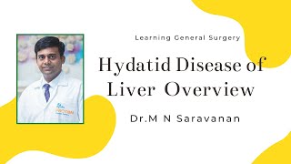 Hydatid Disease of Liver Overview Dr M N Saravanan DNBGS DNBSGE [upl. by Auqinehs]