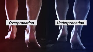 How to Determine your Pronation [upl. by Shalna586]