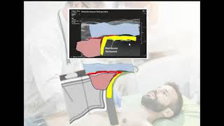 CURSO BASICO DE ECOGRAFIA PULMONAR 3 Tecnica y anatomia [upl. by Nyraf582]