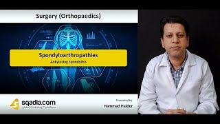 Spondyloarthropathies  Orthopedic Surgery Video Lectures  Medical Education  VLearning [upl. by Vaughan]