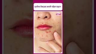 Skincare Tips I दररोज मेकअप करणे पडेल महाग I Daily Makeup is harmful for health [upl. by Ruff]