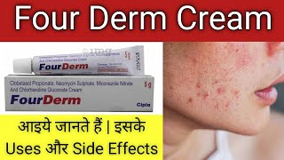 Four Derm Cream Uses and Side EffectsFour Derm CreamAntifungal CreamCream for itchy skin [upl. by Bowerman96]