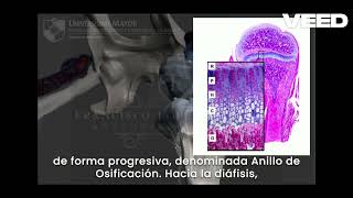 Patología del Sistema Osteoarticular  Parte 8 Osteocondrosis [upl. by Macri654]