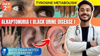 tyrosine metabolism biochemistry  alkaptonuria biochemistry  black urine disease biochemistry [upl. by Lidia]