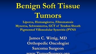 Orthopedic Oncology and Pathology Course  Benign Soft Tissue Tumors Lipoma etc  Lecture 9 [upl. by Sitto]