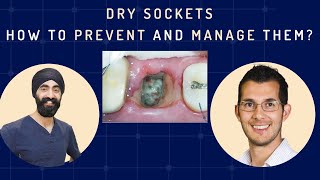 Dry Sockets  How to Prevent and Manage Them Oral Surgery Complications  GF010 [upl. by Orihakat463]