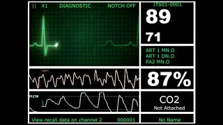 Hospital Monitor with FlatLine L HD [upl. by Meluhs]