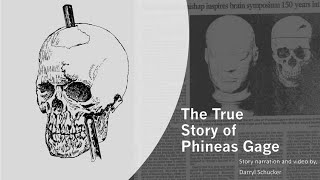 The True Story of Phineas Gage [upl. by Nylkaj211]