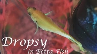 Dropsy in Betta Fish  Symptoms Prevention Life Expectancy amp More [upl. by Eniloj786]