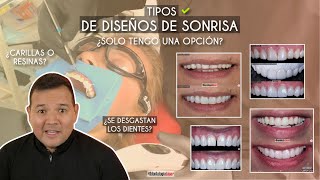 Tipos de Diseños de Sonrisa 🦷 ¿Solo tengo una opción 🤔  Odontología Láser [upl. by Nevar]