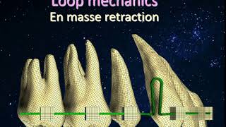 loop mechanics en masse retraction [upl. by Bernadine]