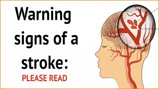 Warning Signs Of A Stroke  Please Watch [upl. by Chuch]