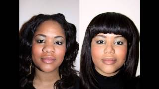 African American Female Rhinoplasty NYC Before amp After Dr Sam Rizk [upl. by Suzann]