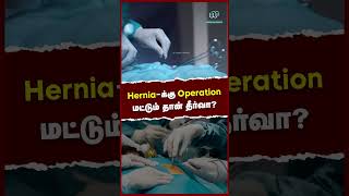 Herniaக்கு Operation மட்டும் தான் தீர்வா  Treatment for Hernia [upl. by Hagile]