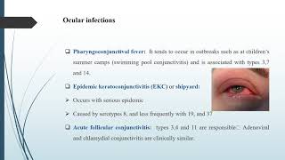 ADENOVIRUS [upl. by Duwad]