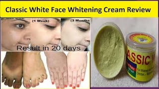 Classic white face whitening cream review  Face and body whitening cream in 5 days [upl. by Zsazsa980]