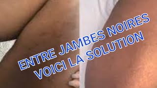 Comment eclaircir les entre jambesnoires une solution efficace 👌 [upl. by Airot]