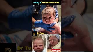 Unique amp Funny Baby expressions 🚼👶 Baby expression 😂 Newborn Babies shortsfeed pregnancy baby [upl. by Elisabeth801]