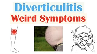 Weird Symptoms of Diverticulitis  Atypical Clinical Features of Diverticulitis [upl. by Nelg]